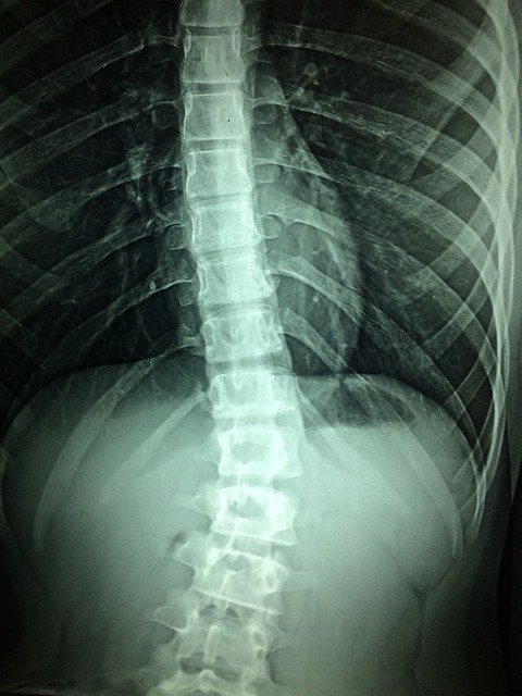 spinal cord x ray