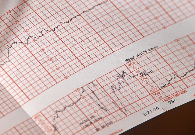 Failed to Diagnose Your Heart Disease
