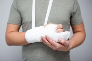 Burn Injuries from Accidents: Types, Treatment, and Legal Options