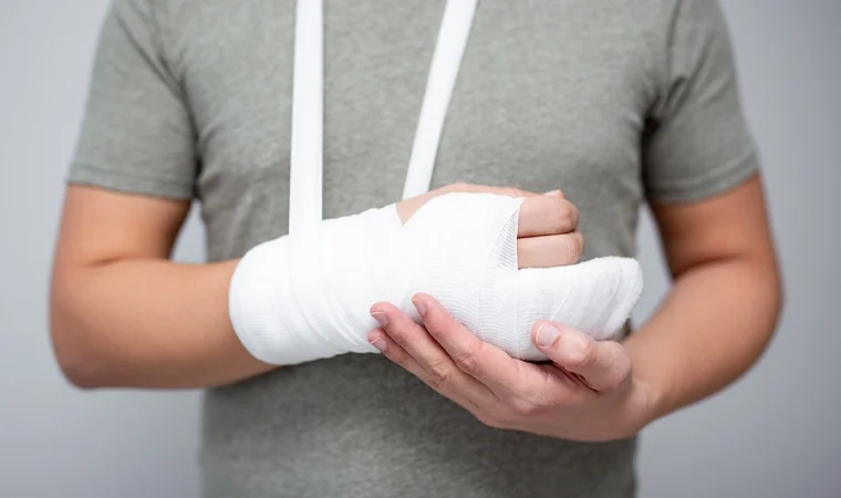 Burn Injuries from Accidents: Types, Treatment, and Legal Options