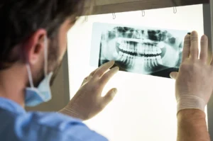 Compensation for Dental Injuries in Florida Personal Injury Cases