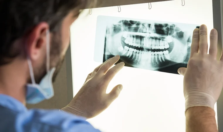 Compensation for Dental Injuries in Florida Personal Injury Cases