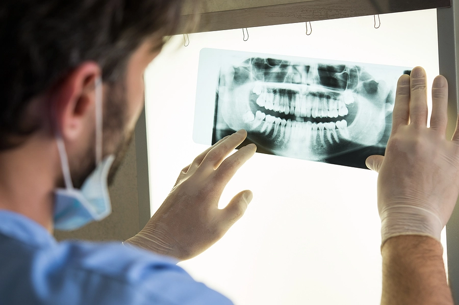 Dentist looking at dental x-ray