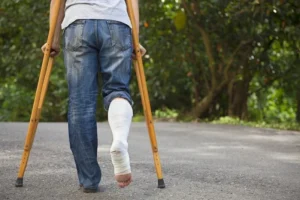 Spinal Cord Injuries After an Accident in Florida: Understanding Long-Term Costs and Compensation